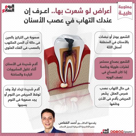 اعراض عصب الاسنان